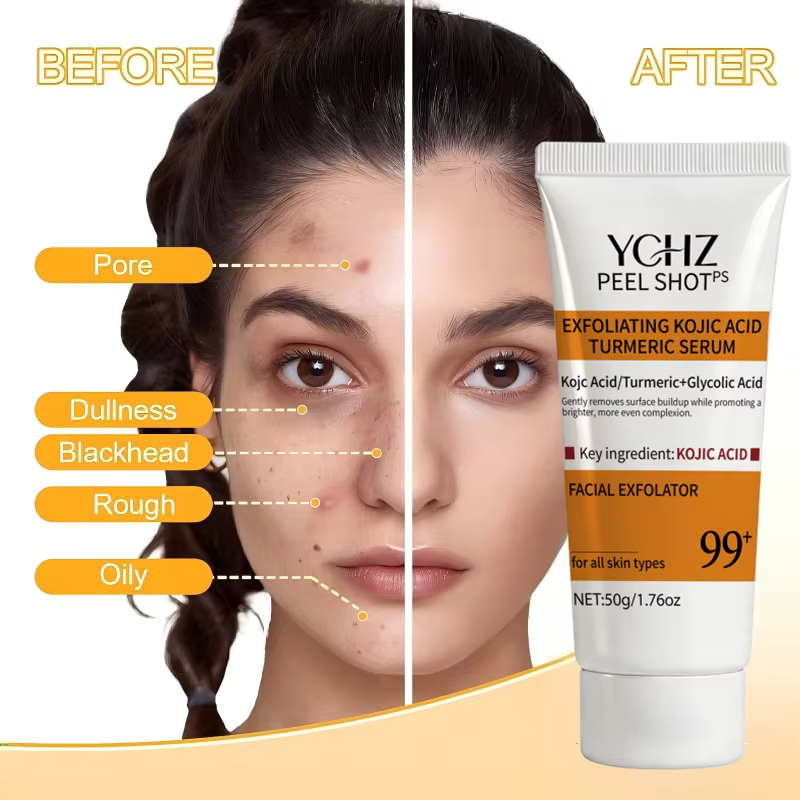 Gel exfoliant à l'acide kojique et au curcuma, adapté au visage et au corps, gommage doux parfumé à l'orange, gel nettoyant pour le corps, élimine les peaux mortes, nettoyant pour la peau - 50 g