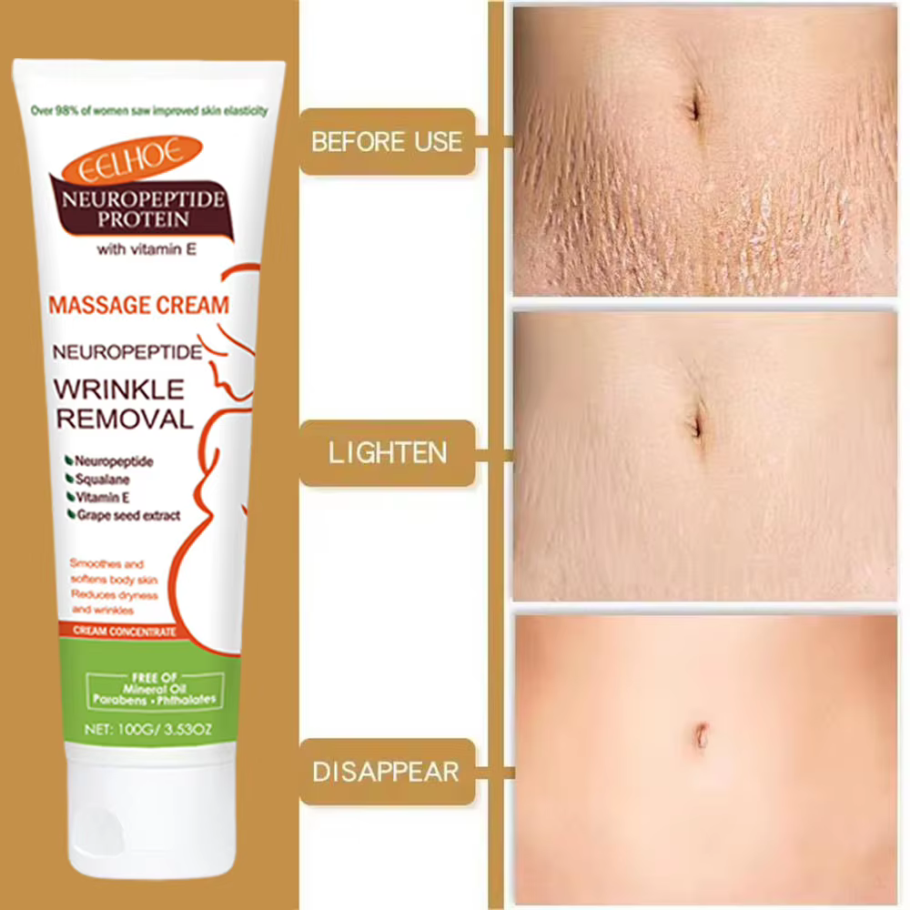 Crème anti-vergetures permanente 100g pour femmes enceintes, soin corporel lissant, réparateur et raffermissant pour la peau