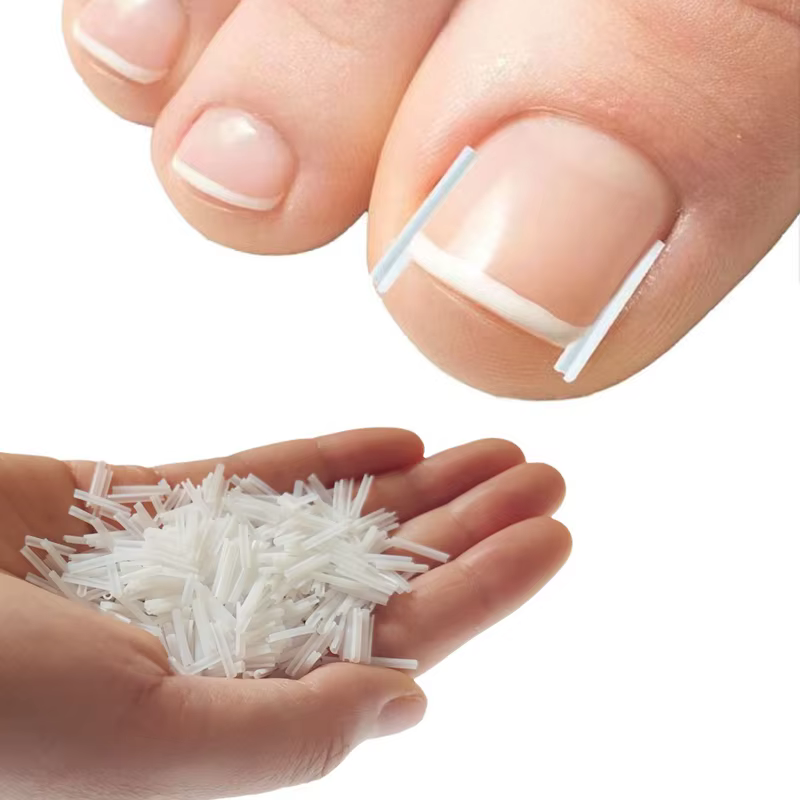 Outil de Correction des ongles incarnés