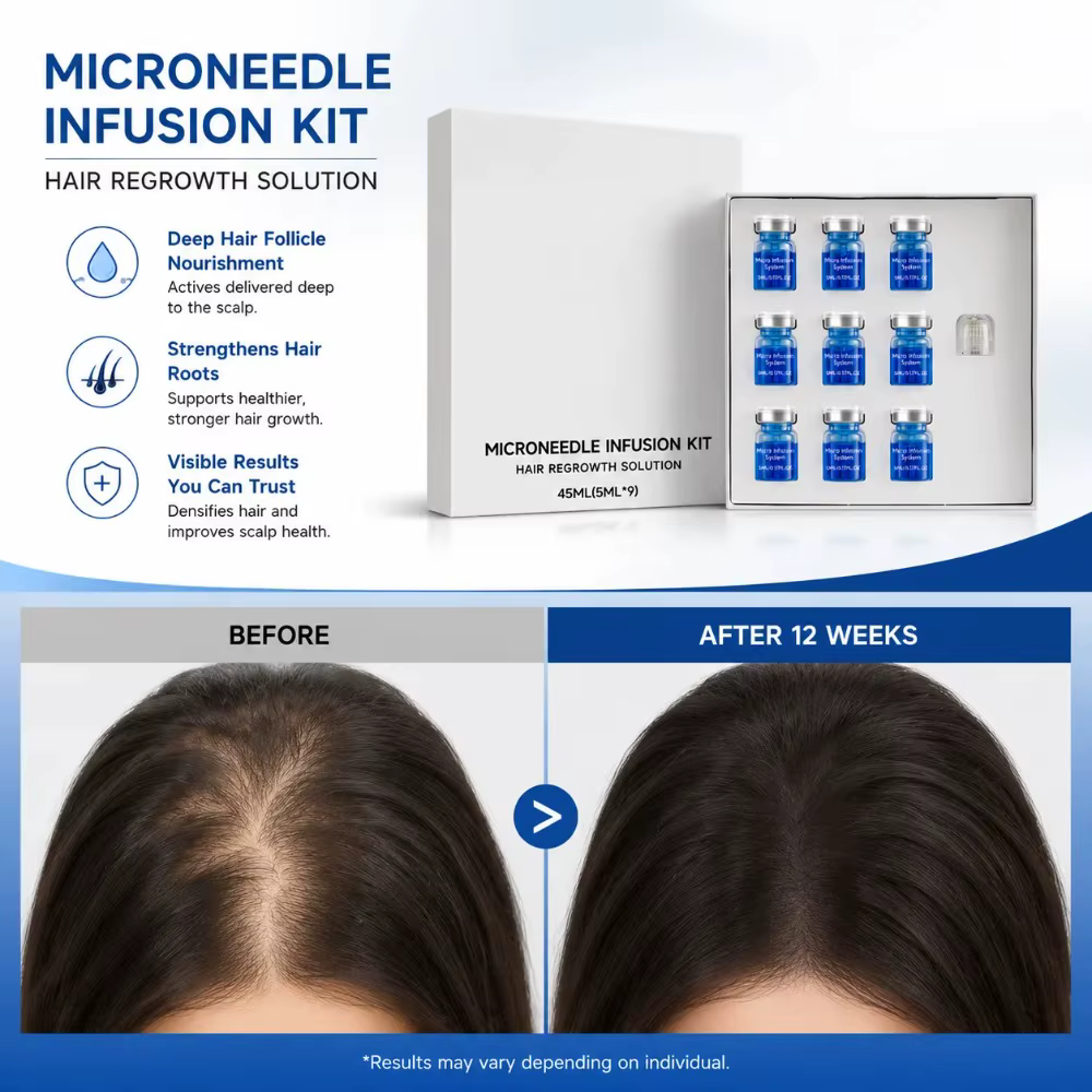 Kit de soins capillaires à micro-aiguilles pour usage domestique, contenant un sérum nutritif, formule douce pour l'entretien quotidien du cuir chevelu