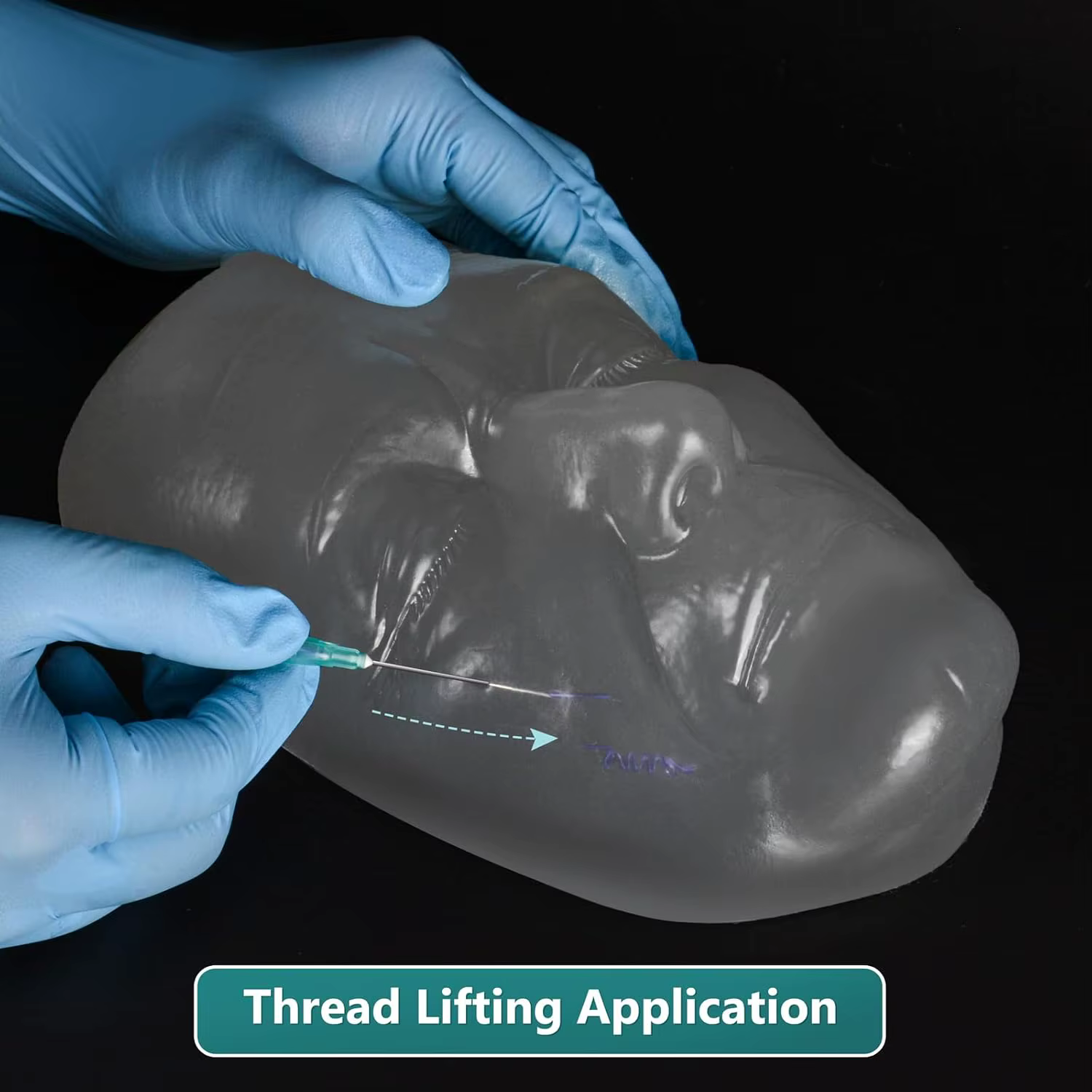 Modèle de tête Ultrassist pour injection faciale et lifting par fils, modèle d'entraînement à l'injection pour esthéticiennes et médecins