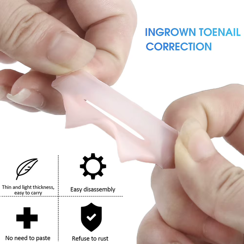 Pexmen 2/4/10 pièces Gel correcteur d'ongle incarné manches gros orteil ongles guérison soins protecteurs Paronychia traitement pédicure outil