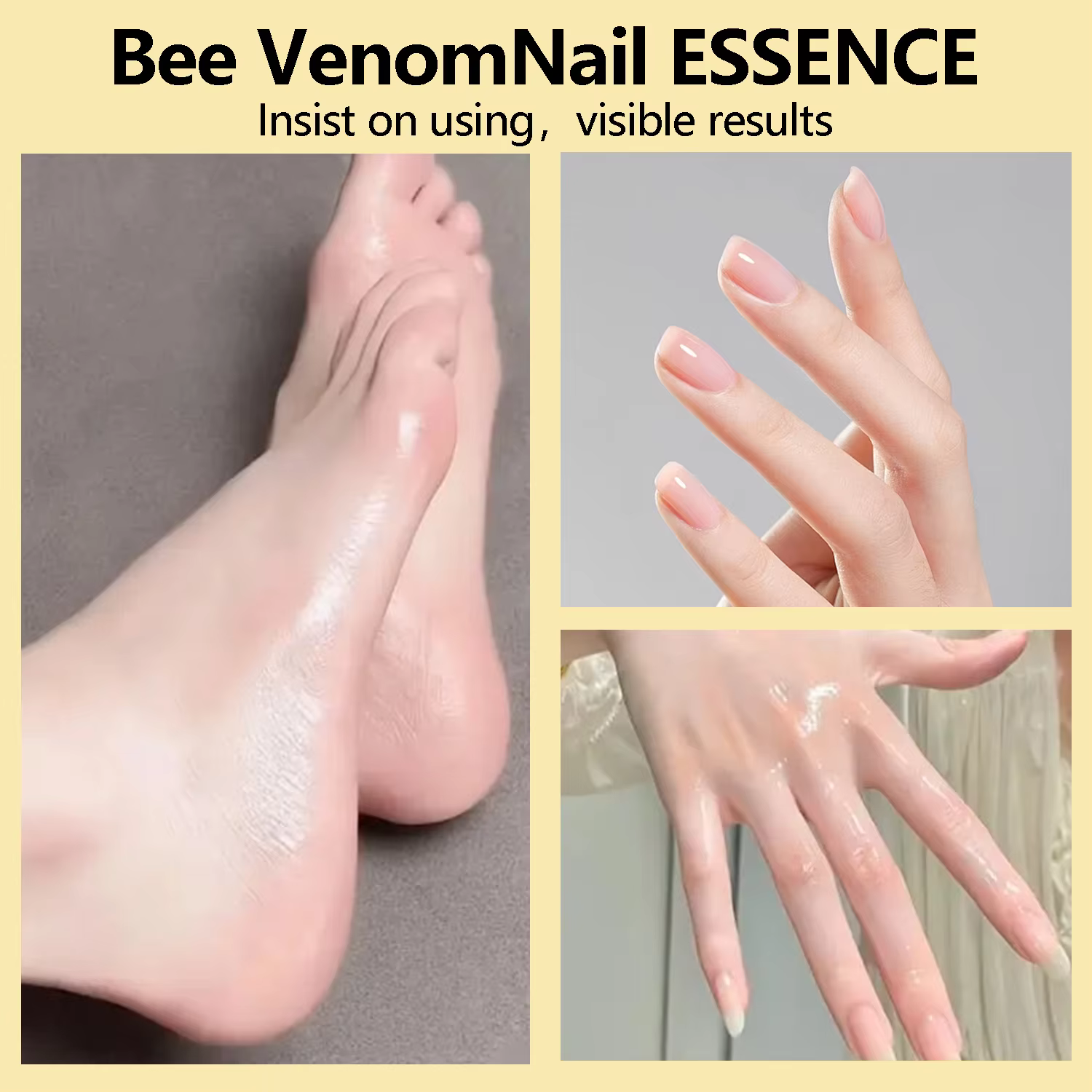 Essence pour ongles au venin d'abeille - Action rapide 7X