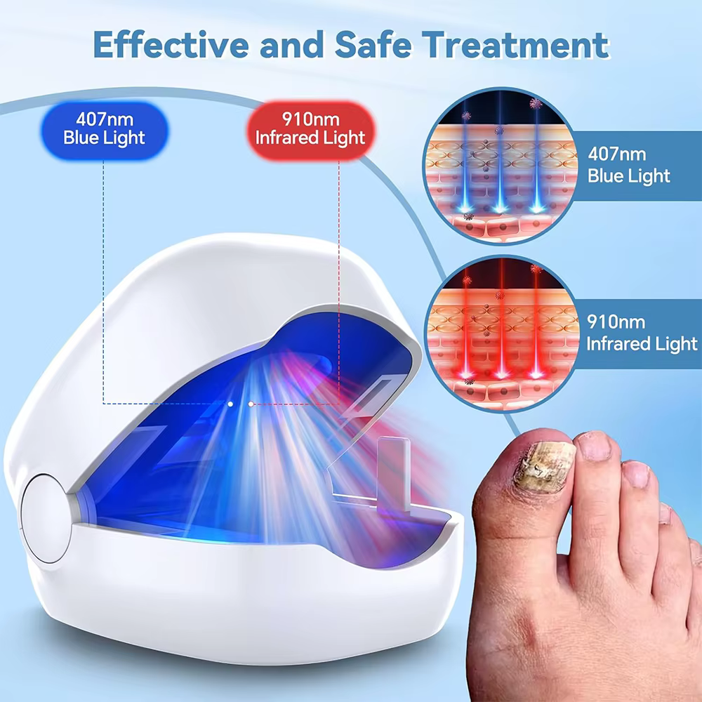 Dispositif de lumière LED Laser pour champignons des ongles