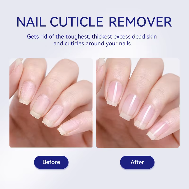 LILYCUTE 30ml dissolvant de cuticules Gel adoucissant rapide pour les ongles peau morte