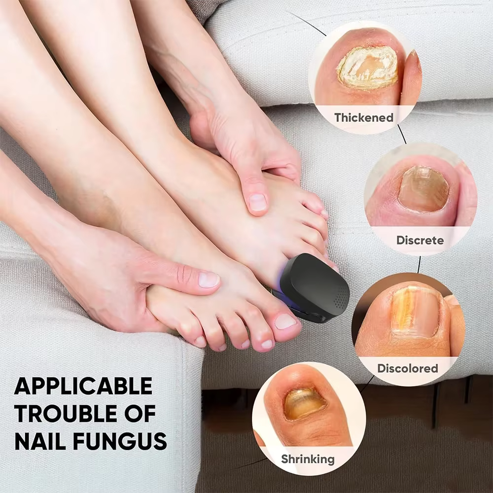 Appareil laser LED pour le traitement des champignons des ongles