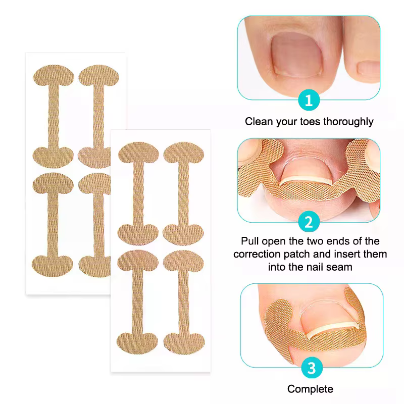 Ensemble d'autocollants correcteurs professionnels pour les ongles des pieds