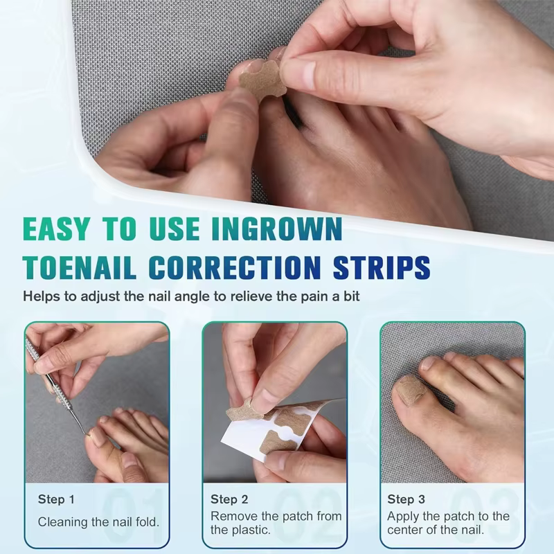 Autocollants de Correction des ongles incarnés