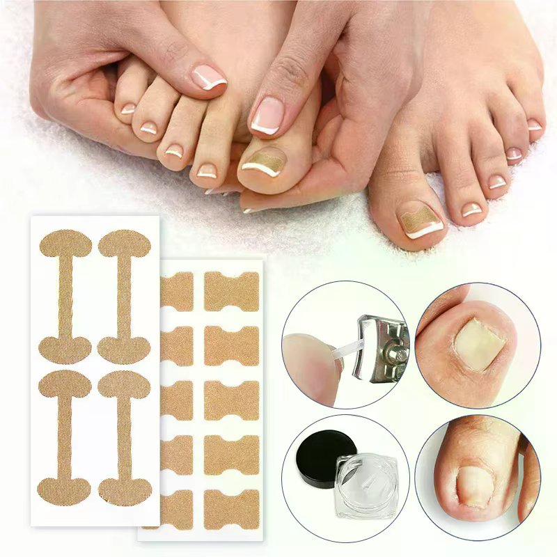 Ensemble d'autocollants correcteurs professionnels pour les ongles des pieds