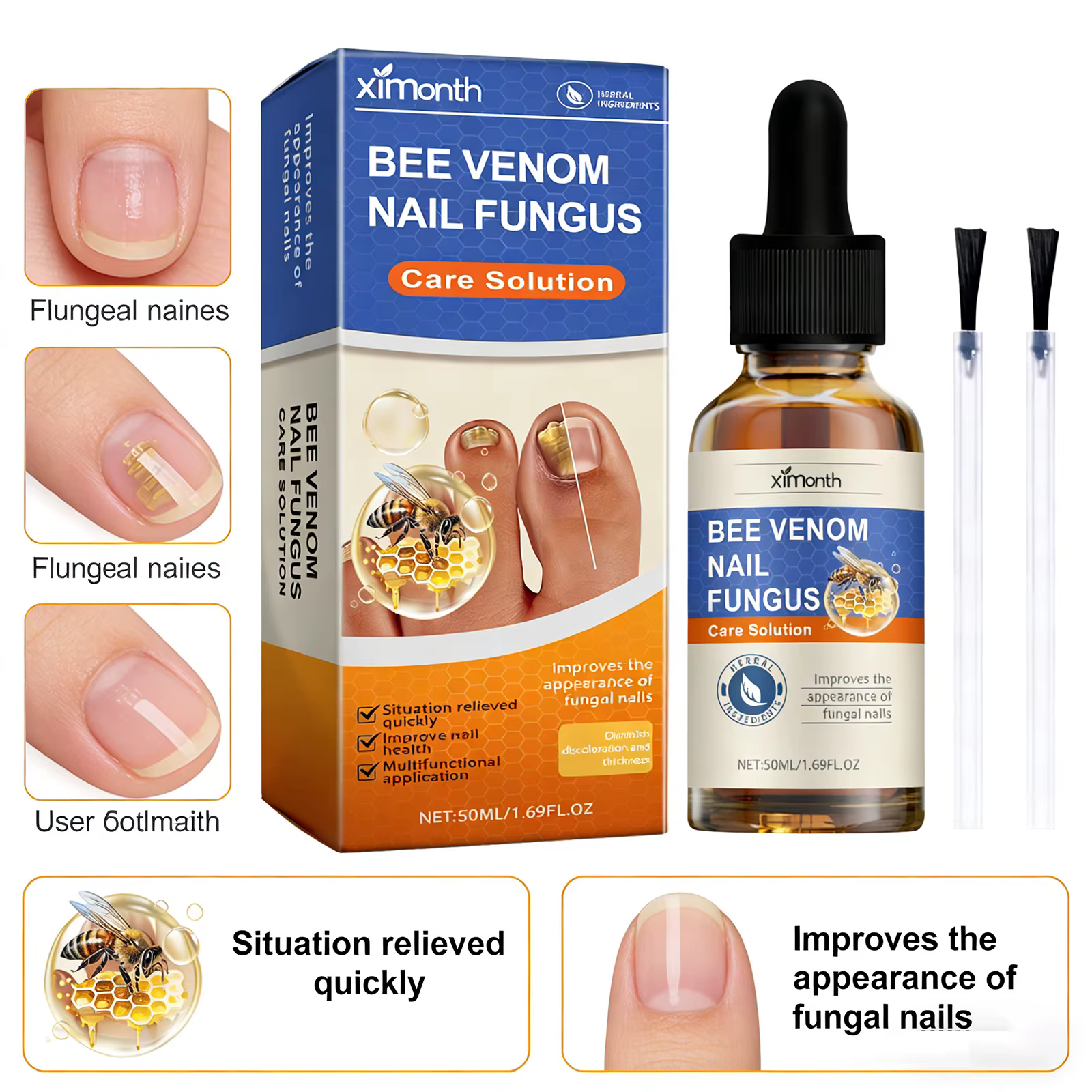 Solution de soin des ongles contre les mycoses
