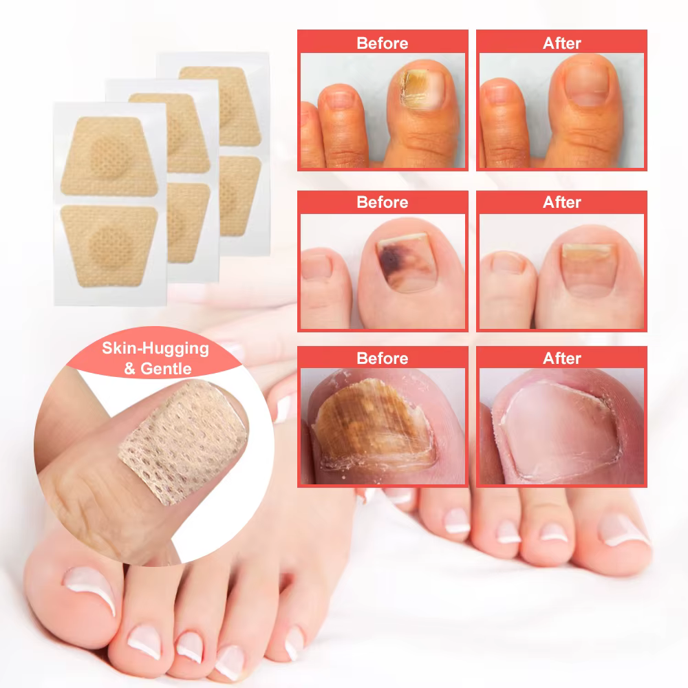 Patchs réparateurs pour ongles