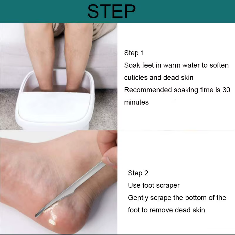 Manucure pédicure outils orteil ongles rasoir pieds