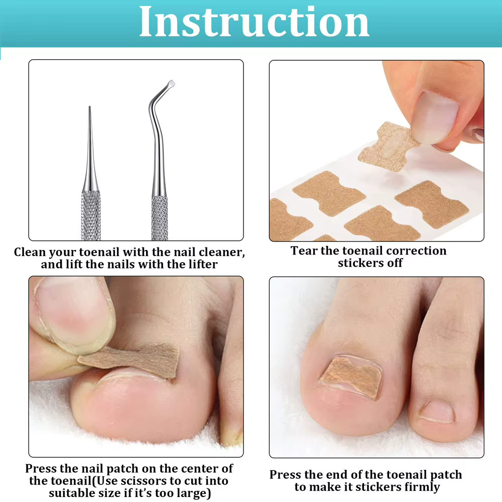 Patch autocollant pour traitement des ongles incarnés