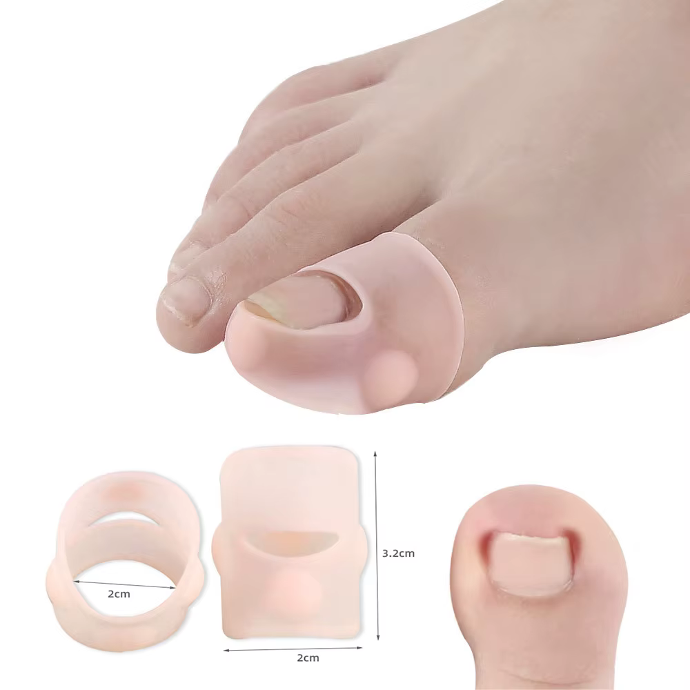 Pexmen 2/4/10 pièces Gel correcteur d'ongle incarné manches gros orteil ongles guérison soins protecteurs Paronychia traitement pédicure outil
