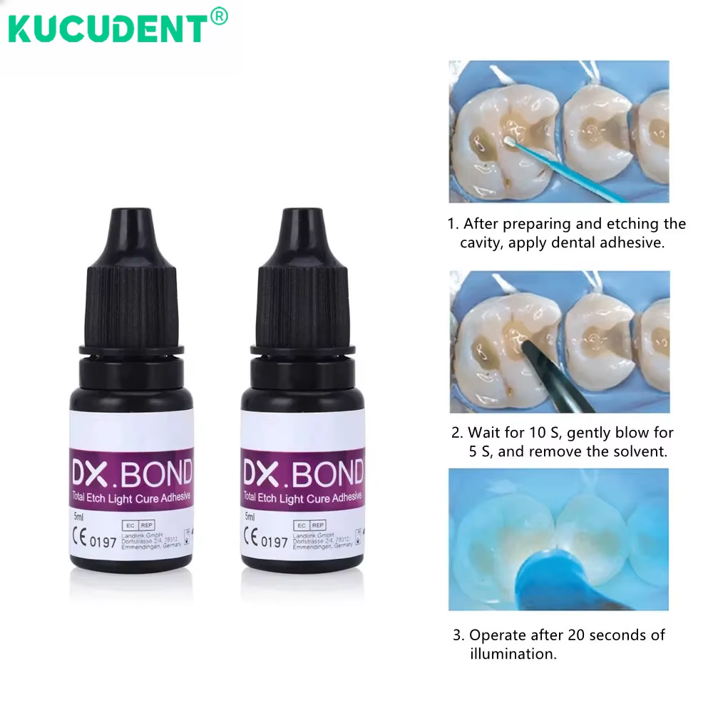 DX.BOND adhésif dentaire photopolymérisable 5ML Agent de gravure totale Gel de gravure acide colle pour dents matériau d'apprêt en résine Composite photopolymérisable
