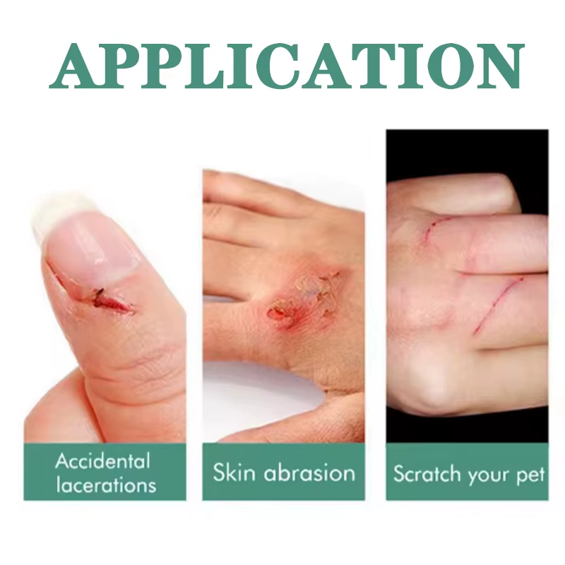 Gel hémostatique à action rapide pour manucure et cuticules – Soulagement