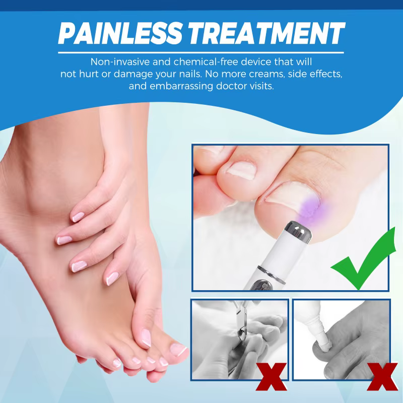 Stylo de traitement antifongique pour les ongles