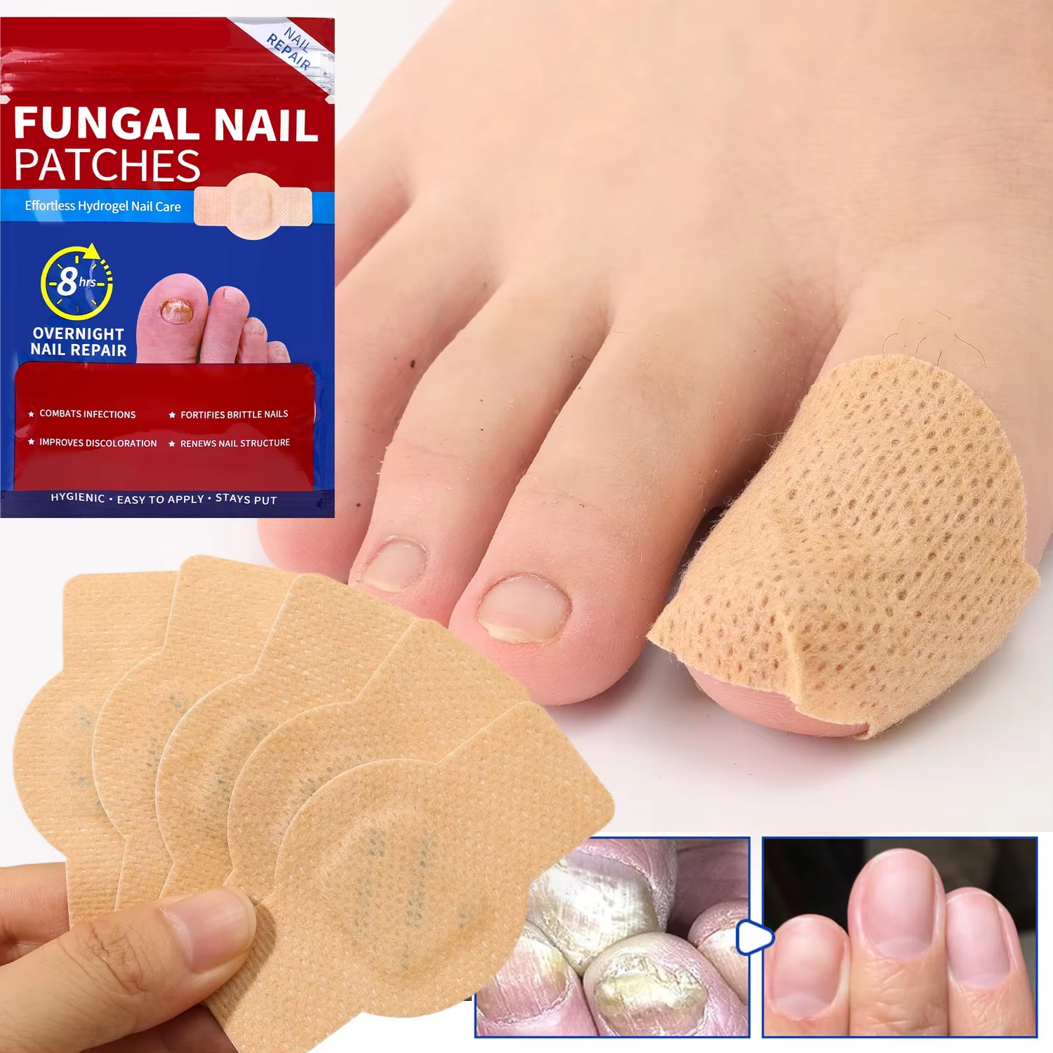 Patch de réparation des ongles imperméable